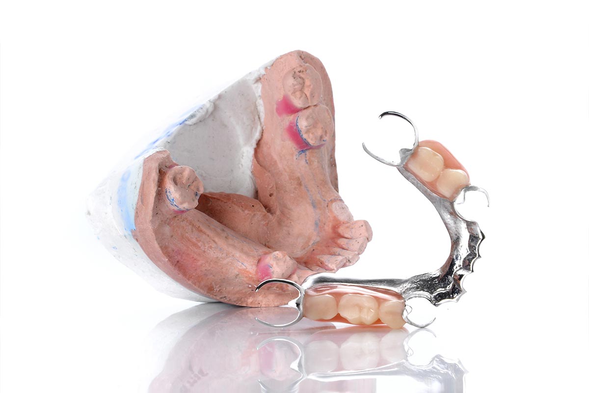 denture-mold-false-teeth-on-white-background-2024-12-06-08-19-50-utc