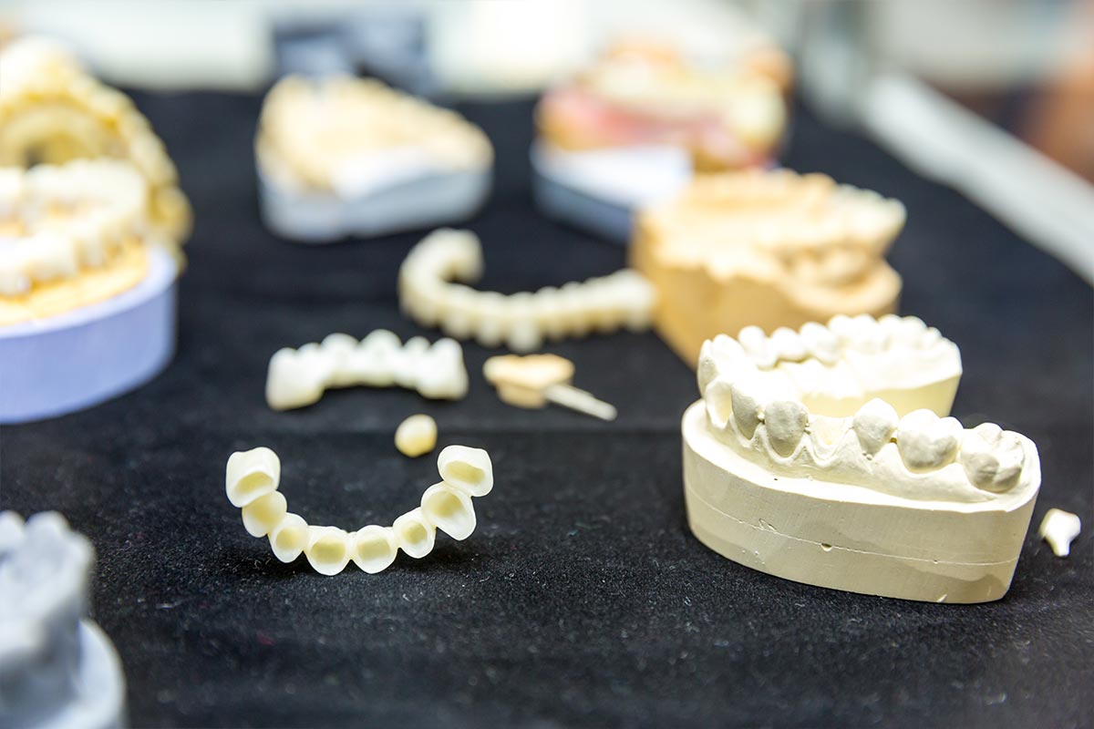 denture-treatment-dental-implants-closeup-2024-11-26-05-40-48-utc
