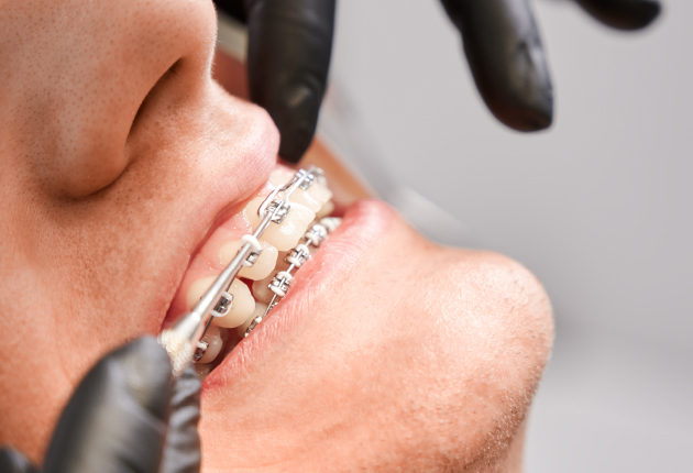 orthodontiki1