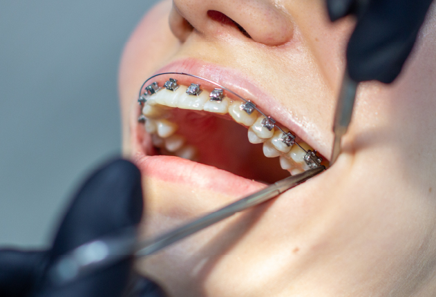 orthodontiki2